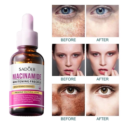 Picture of SADOER Niacinamide Skin Whitening Face Serum for Shrink Pores, Dark Spots and Freckles serum-30ml