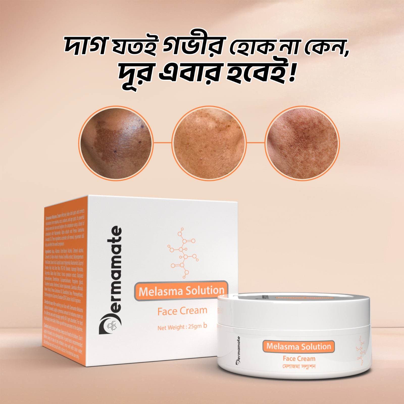 Picture of Dermamate Melasma Solution Face Cream 25ml