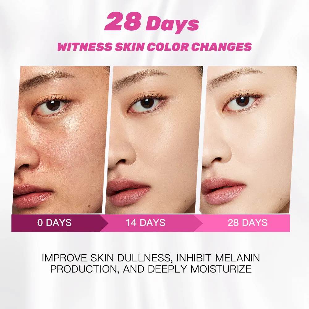 Picture of Kojic Acid Whitening Serum-30ml