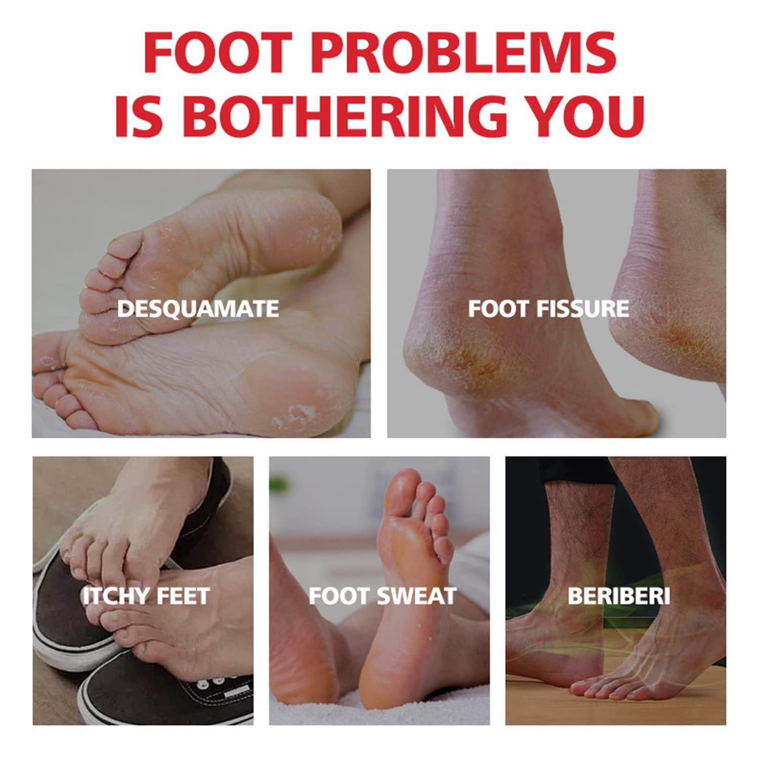 Picture of Aichun Beauty Foot Cream Balm For Cracked Heel Dead Skin Remover Foot Cream Anti-Crack Deep Moisturizing Foot Cream-20gm