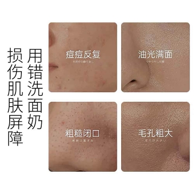 Picture of OSUFI Vitamin B5 Salicylic Acid Brighten Deep Cleansing Pores Melanin Removal Oil Control Moisturizing Gentle Face Wash -100gm