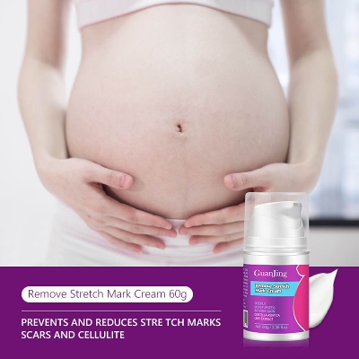 Picture of Guanjing Remove Stretch Mark Cream 60gm Deeply Moisturizes & Firms Skin Prevents and Reduces Scars and Cellulite