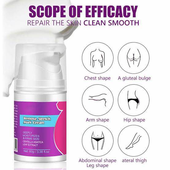 Picture of Guanjing Remove Stretch Mark Cream 60gm Deeply Moisturizes & Firms Skin Prevents and Reduces Scars and Cellulite