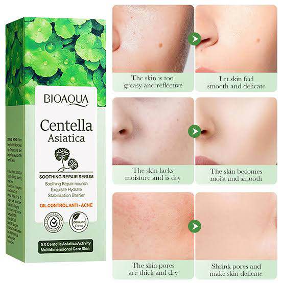 Picture of BIOAQUA Centella Asiatica Soothing Repair Facial Serum Nourish Oil Control Anti-Acne Face Skin Care 30ml