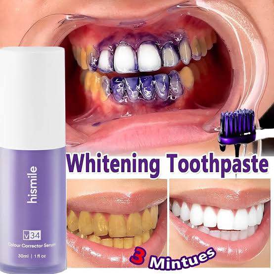 Picture of Hismile v34 Whitening Toothpaste Colour Corrector Teeth Stain Removal-30ml