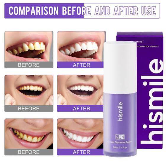 Picture of Hismile v34 Whitening Toothpaste Colour Corrector Teeth Stain Removal-30ml