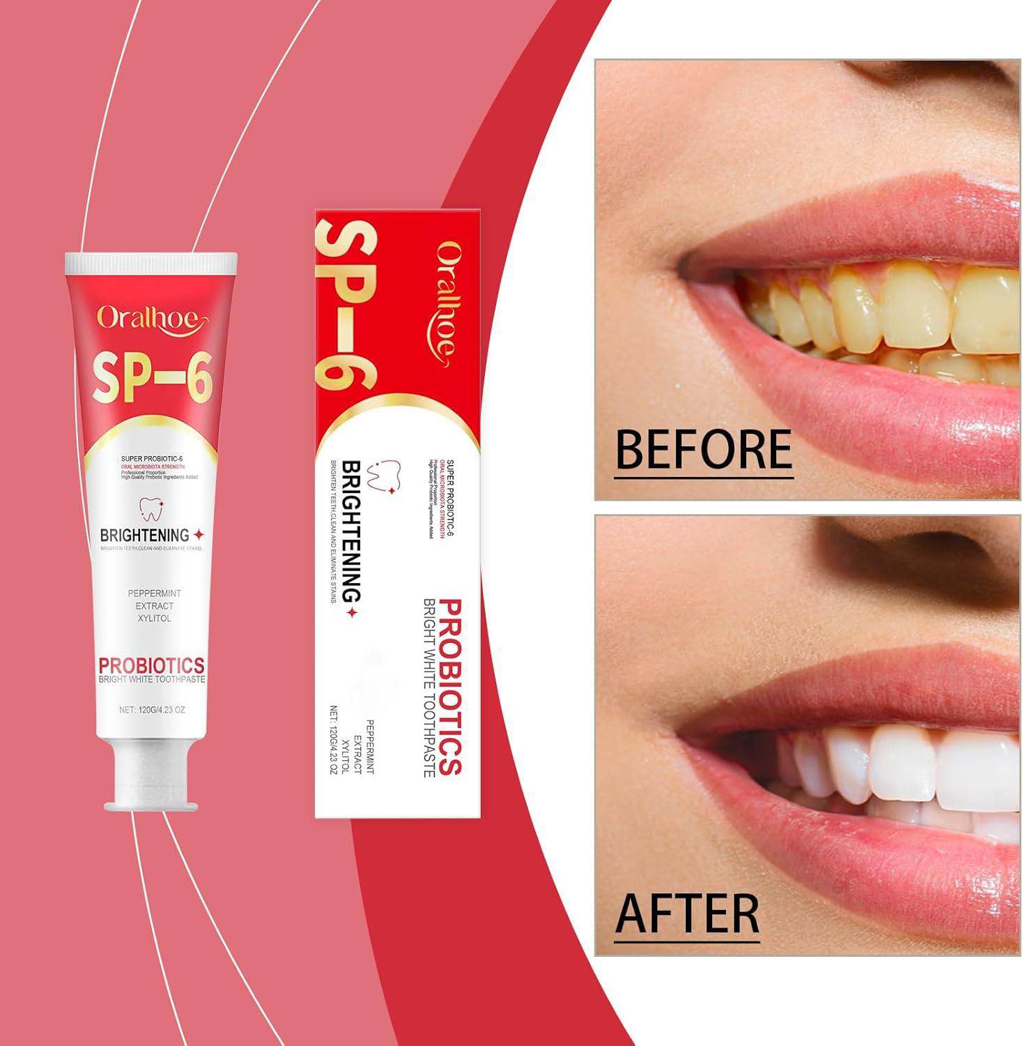 Picture of Oralhoe SP-6 Brightening + PROBIOTICS Bright White Toothpaste
