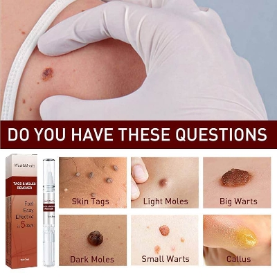 Picture of West Month Tags Moles Remover Pen 3ml