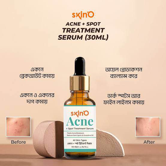 Picture of skinO Acne + Spot Treatment Serum - 30ml to all skin type