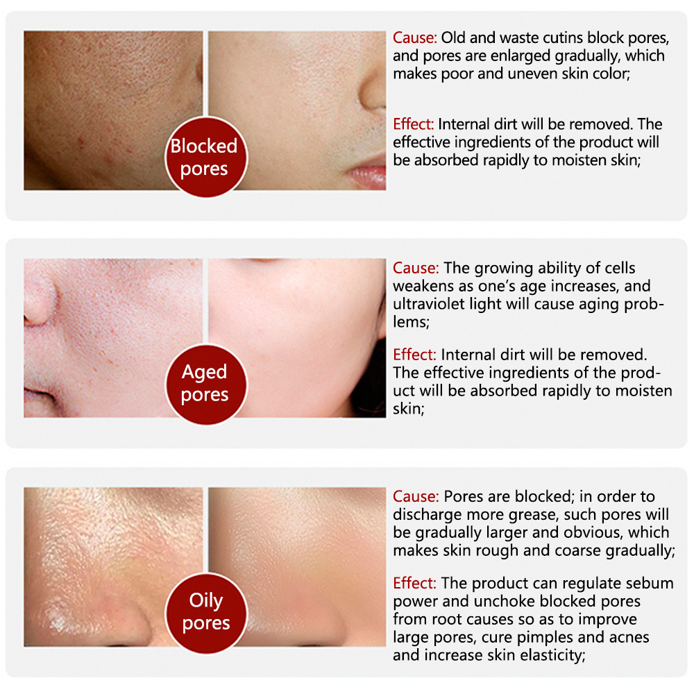 Picture of LANBENA Pore Treatment vitamin c Serum Essence Moisturizing Repairing Smooth Skin Care- 15ml Serum