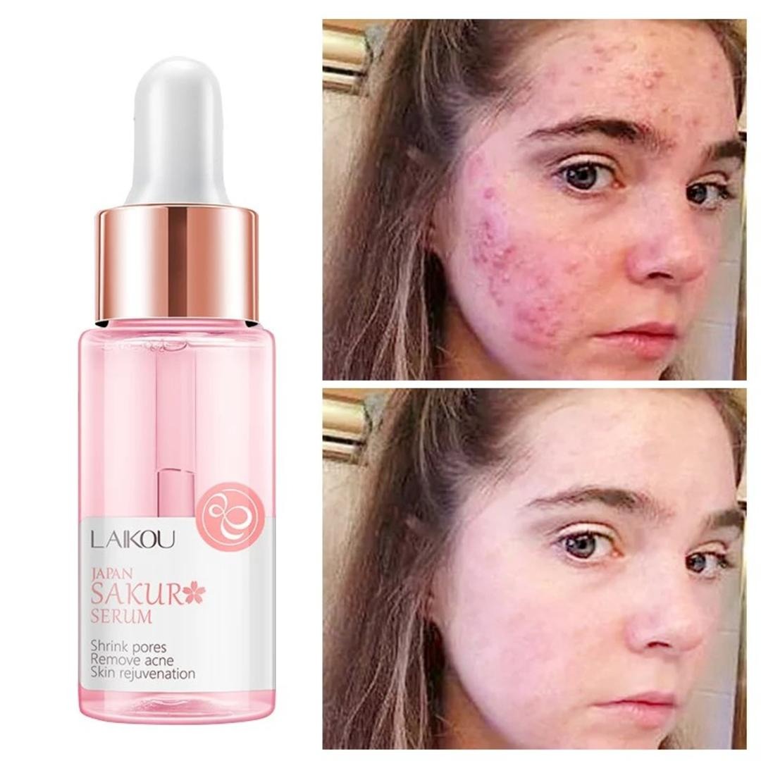 Picture of LAKOU Japan Sakura Tighten Pores & Skin Rejuvenation Serum- 17ml