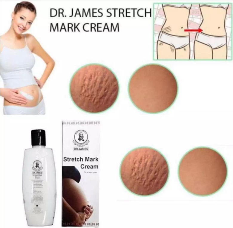 Picture of Thailand Skin Care Dr.James Stretch Cream - 200 Ml