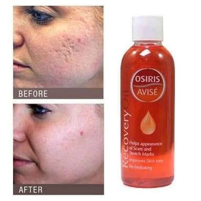 Picture of International UK product Skin care Osiris Avise Recovery oil used for male/female - 100 ml