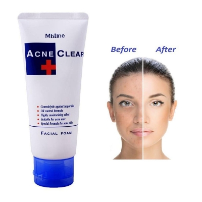 Picture of International Thailand product Skin care Mistine Acne Clear + used for male/female - 85 gm