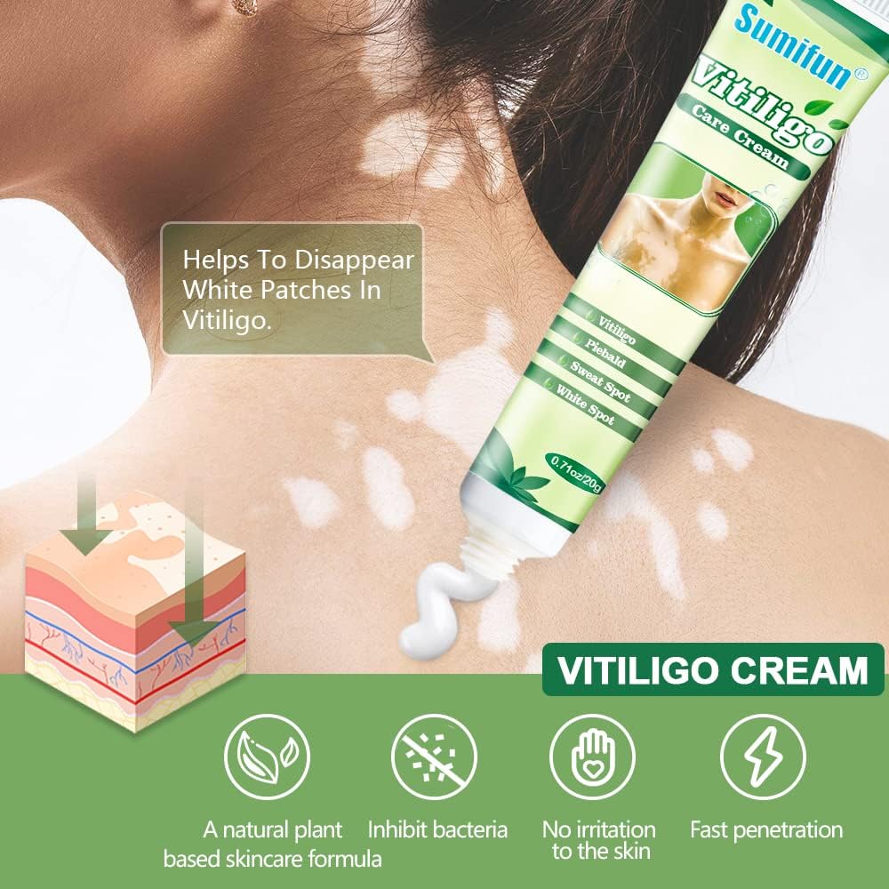 Picture of Sumifun Vitiligo Cream, Vitiligo Care Cream for Skin Vitiligo, Psoriasis, Leukoplakia - Reduces White Spots on Skin, Pigmentation regulating and Improve Skin Pigmentation - 1 Counts