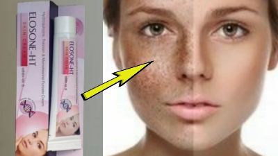 Picture of ELOSONE-HT Skin Cream - 15gm (Indian) 1 Pcs
