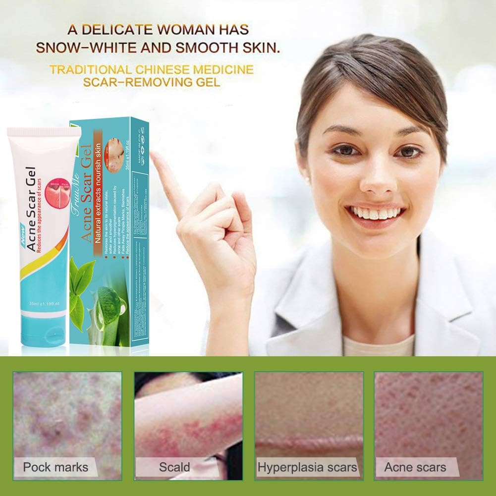Picture of Acne Scar Gel - Treatment Pimple Spot Removal Gel - 35 ml