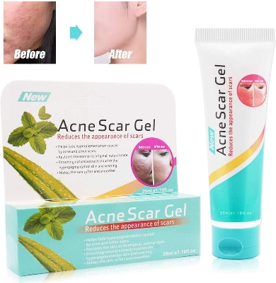 Picture of Acne Scar Gel - Treatment Pimple Spot Removal Gel - 35 ml