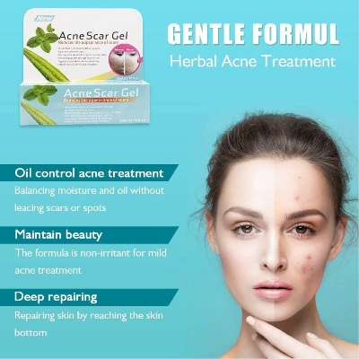 Picture of Acne Scar Gel - Treatment Pimple Spot Removal Gel - 35 ml