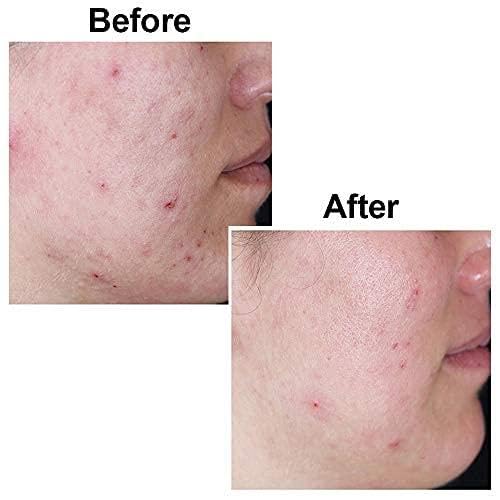 Picture of Internetional Kojie San Facial Beauty Soap 135g