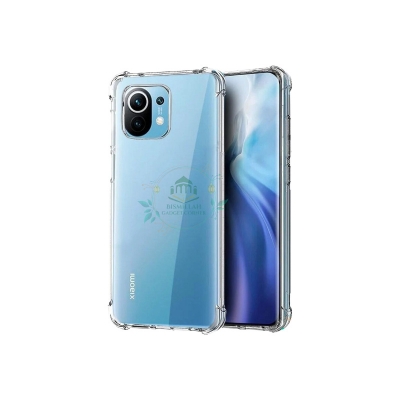 Picture of Transparent back cover For Xiaomi Mi 11 Lite / Xiaomi Mi11 Lite 5G NE , Xiaomi 11 Lite 5G / Xiaomi 11 Lite 5G NE Luxury transparent Protect Back Cover Soft Case