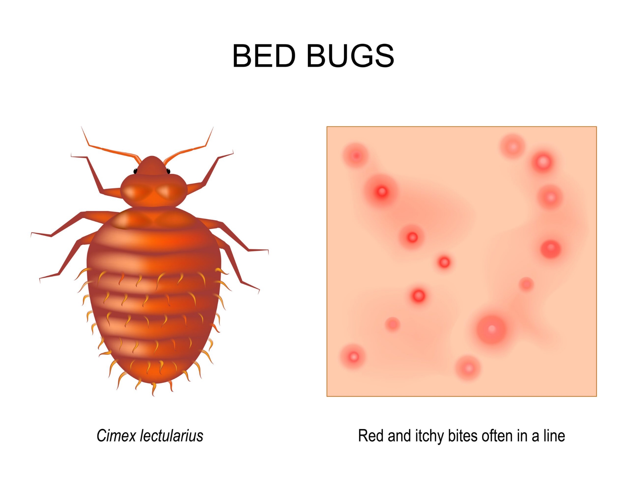 Picture of Knock Down BED BUG KILLER (CHARPOKA) CONTROL SPRAY ১০০% গ্যারান্টি