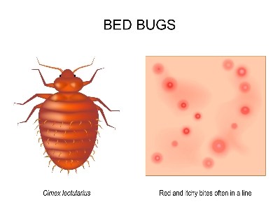 Picture of Knock Down BED BUG KILLER (CHARPOKA) CONTROL SPRAY ১০০% গ্যারান্টি