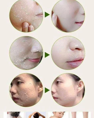 Picture of Yan Namei Ji Tomato Peeling Gel - 320mL