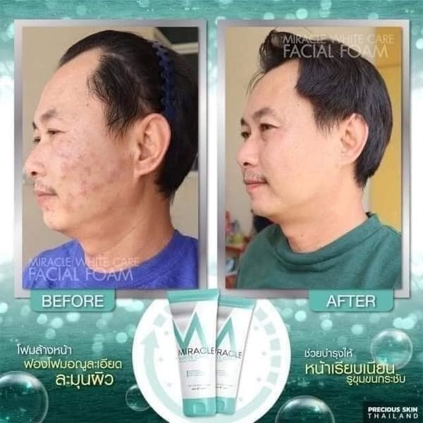 Picture of Miracle white care foam Face wash-120ml