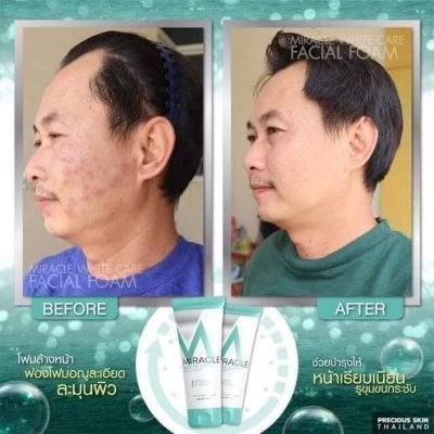Picture of Miracle white care foam Face wash-120ml