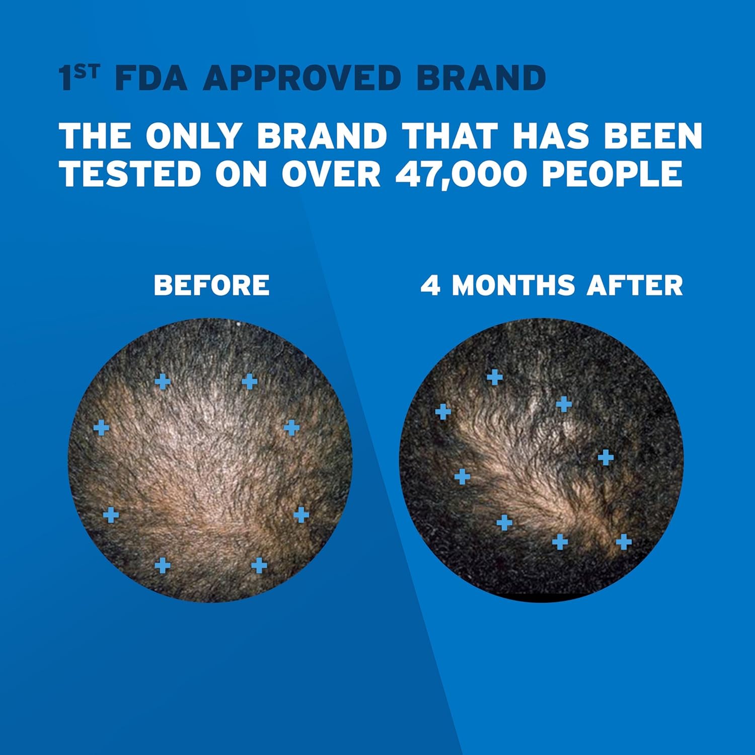 Picture of Rogaine minoxidil foam 5% (one month supply)(no box)