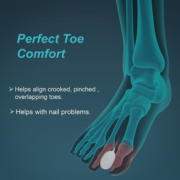 Picture of Toe separator Silicone Splint,(With Toe separator pain Relief Adjustable)