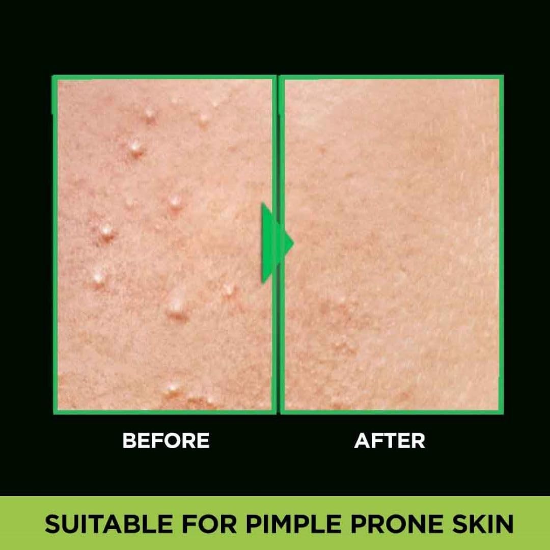 Picture of 50 ml Garnier Men Acno Fight Anti-Pimple face wash Indian product