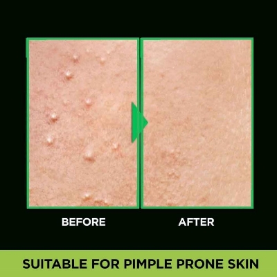 Picture of 50 ml Garnier Men Acno Fight Anti-Pimple face wash Indian product