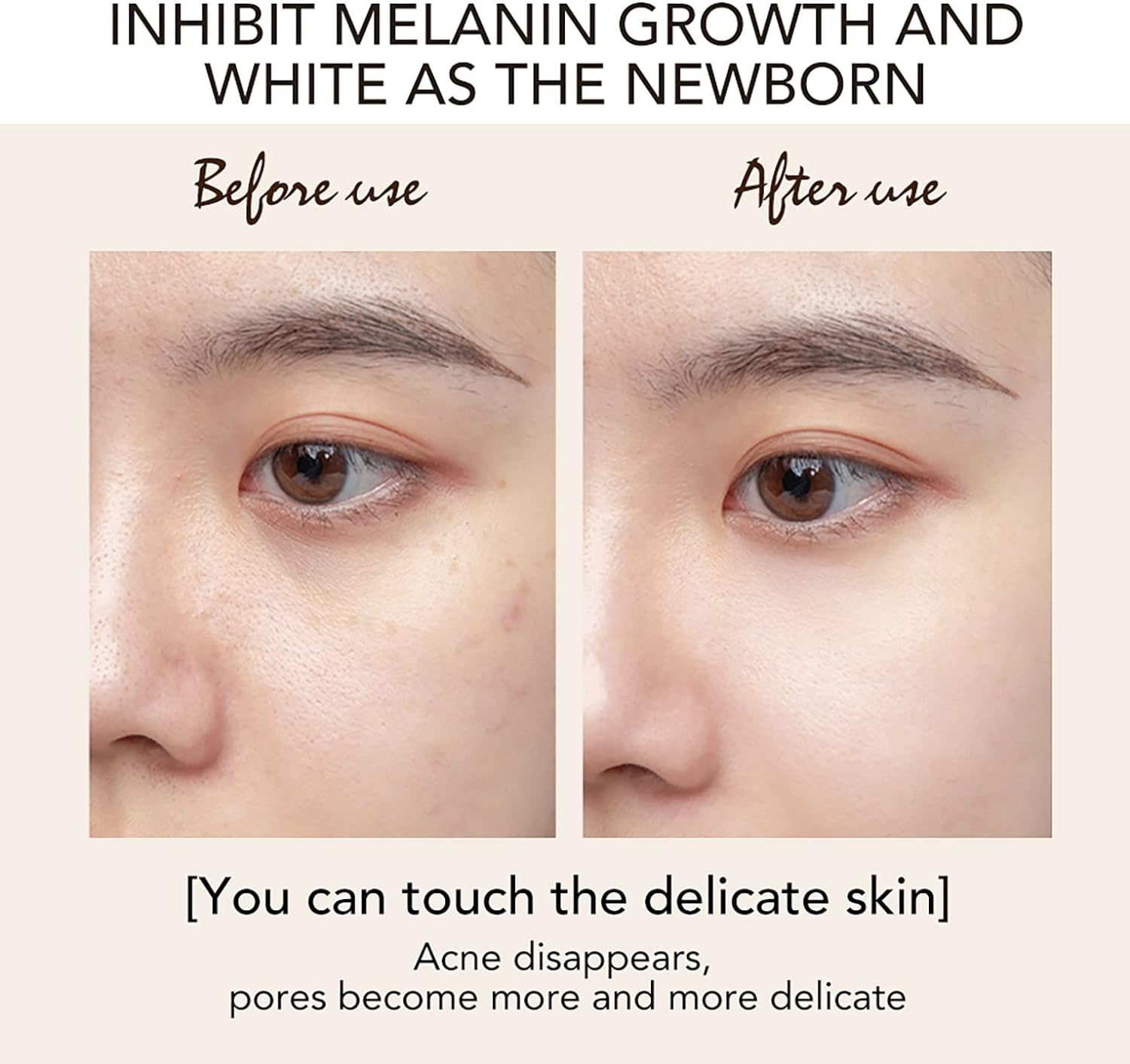 Picture of International Thailand Product Alike Kojic Acid Brightening Cream-25gm