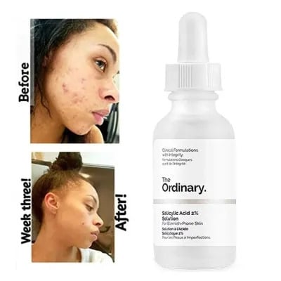 Picture of International Canada Product Ordinary Salicylic Acid 2% Solution (Canada) - 30ml