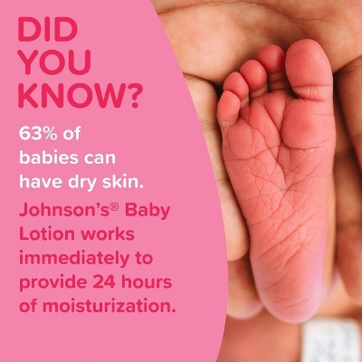 Johnson's Baby Lotion Baby Soft Skin 500ml (Malaysia) IDConline shop bangladeshothoba.com Johnson's Baby Lotion Baby Soft Skin 500ml (Malaysia) IDConline shop bangladeshothoba.com