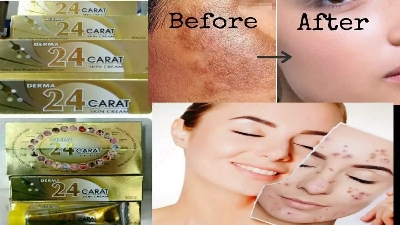 Picture of Derma 24 Carat Skin Cream 25g