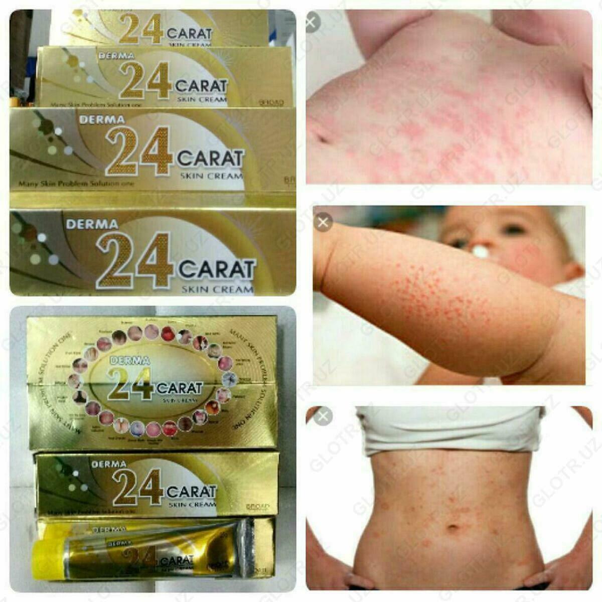 Picture of Derma 24 Carat Skin Cream 25g