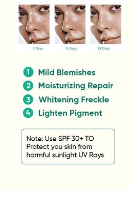 Picture of Dark Spot Removal | Mooyam Dark Spot Remove | Whitening Freckle Cream | Freckle Cream | Dark Sport Remover for Women