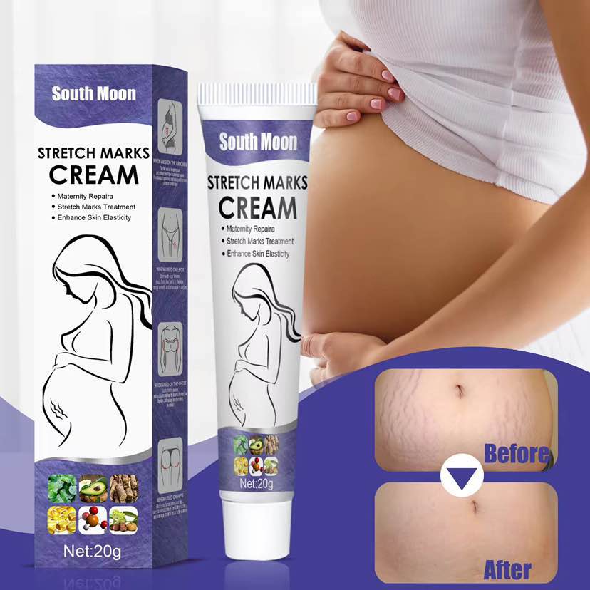 Picture of South Moon Stretch Marks Repair Cream | Effective Body Stretch Marks Removal Cream