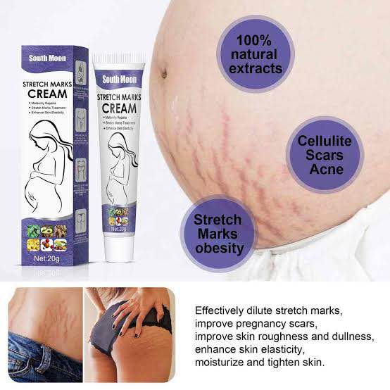 Picture of South Moon Stretch Marks Repair Cream | Effective Body Stretch Marks Removal Cream