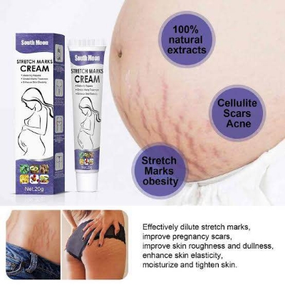 Picture of South Moon Stretch Marks Repair Cream | Effective Body Stretch Marks Removal Cream