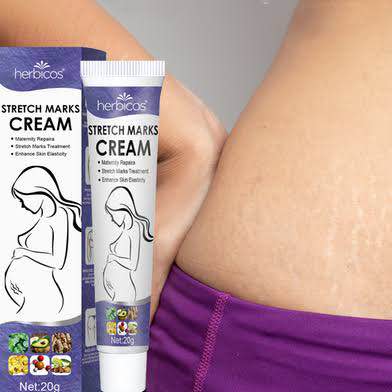 Picture of South Moon Stretch Marks Repair Cream | Effective Body Stretch Marks Removal Cream