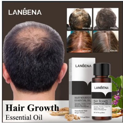 Picture of Hair Growth Essential Oil 20ml