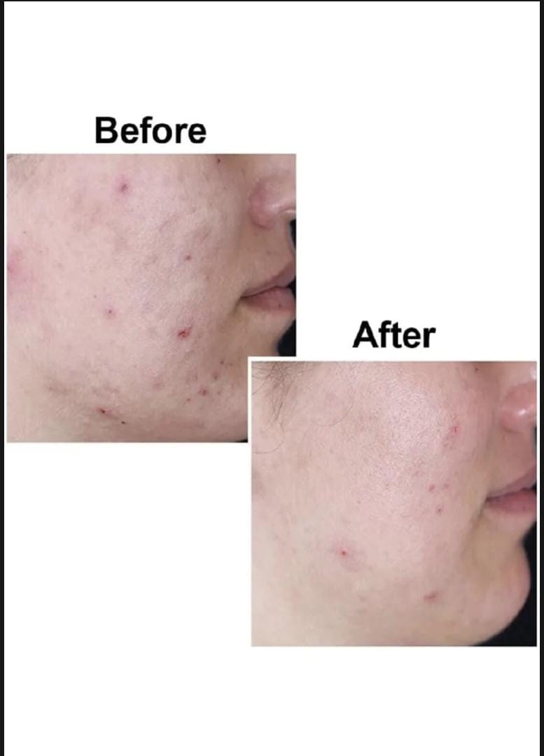 Picture of Kojie San Skin Lightening Even Skin Tone 3 Pcs Soap- 65gX3