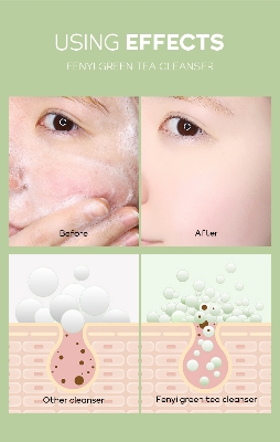 Picture of Fenyi Tea Tree Acne Removal Face Toner Repairing Soothing Tighten Pores - 100ml