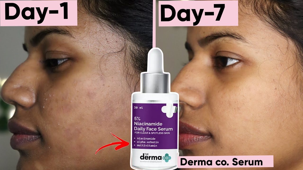 Picture of The Derma Co 5% Niacinamide Daily Face Serum with Alpha Arbutin & Multivitamin for Clear & Spotless Skin - 30ml