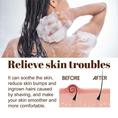 Picture of Davey Black Soape - 100gm Oily Control Acne care Deep Cleaning