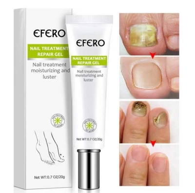 Picture of Efero Nail Repair Treatment Gel Fungus Cream-20gm